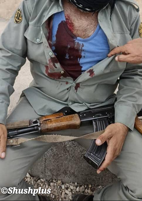مصدومیت محیط بان پارک ملی کرخه در درگیری با متخلفان